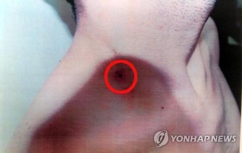 '인권사각' 청주 외국인 보호소, 가스총 협박에 폭행(종합) - 3