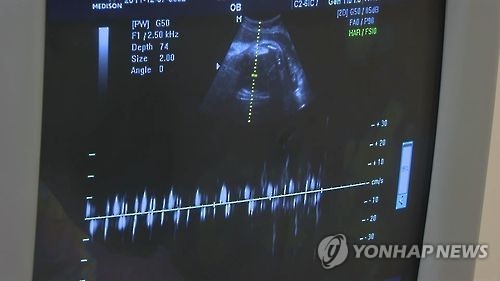 건강보험 적용되니 오히려 비싸지는 임신부 초음파? - 1