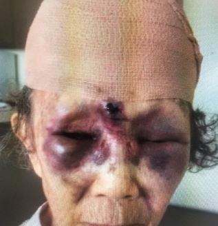 미 LA 한인타운에서 폭행당한 한인 할머니