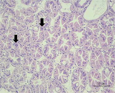 AHPND에 감염된 새우 간 췌장 현미경 사진