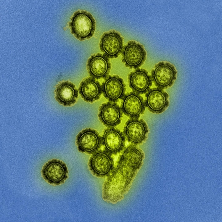 전자 현미경으로 촬영한 H1N1 인플루엔자 바이러스