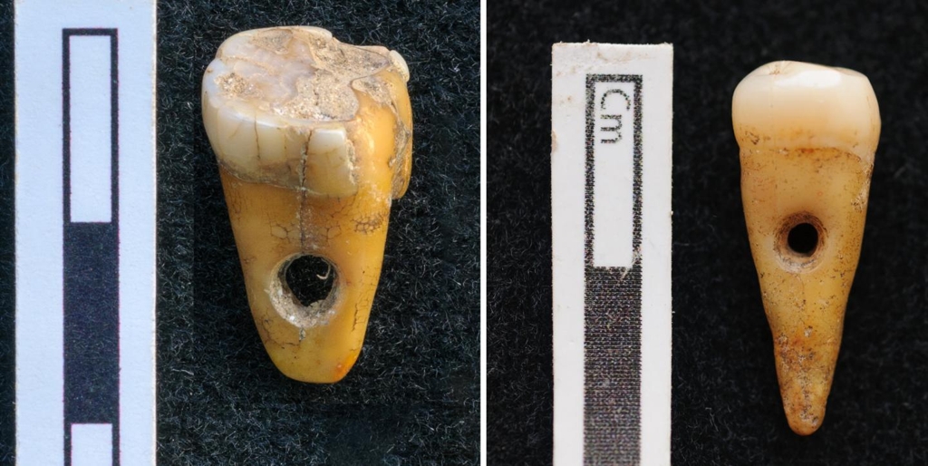 사람 이빨에 구멍을 뚫은 8천500년 전 장신구