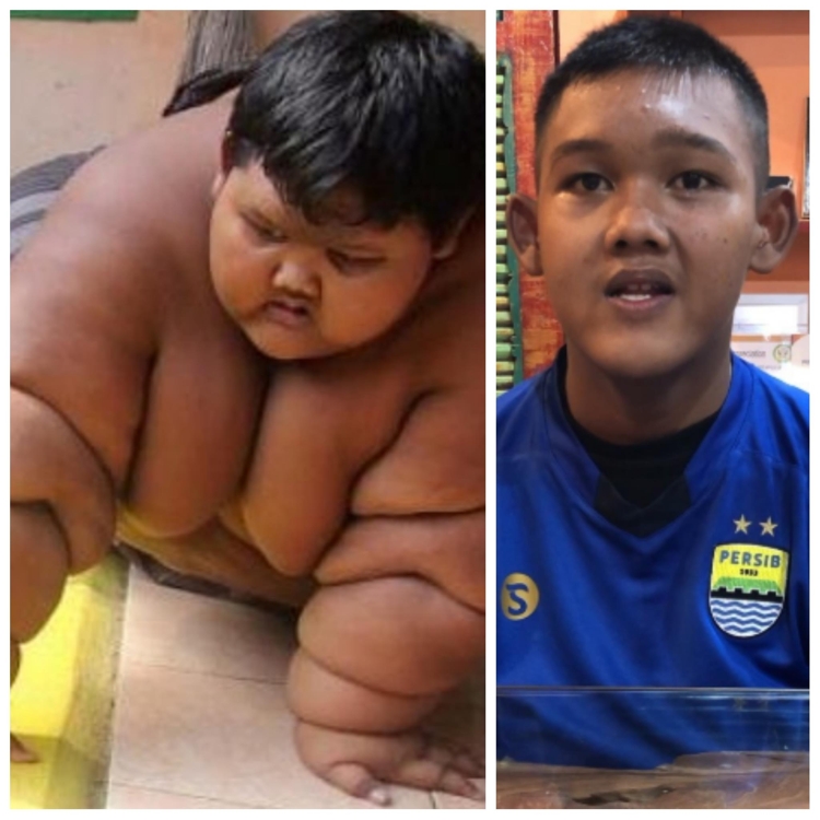 3년간 109㎏ 감량한 인도네시아 소년