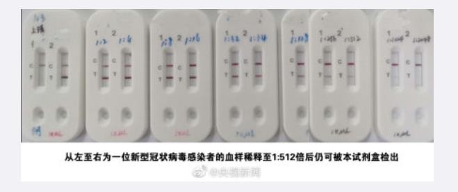 중국 연구진, 피 한 방울로 15분 내 감염 검사 키트 개발