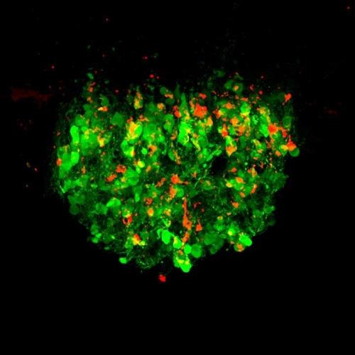 장의 신호로 흥분한 생쥐 뇌의 갈증 제어 뉴런(녹색·붉은색) 