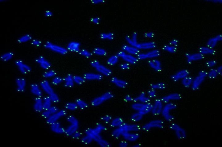 인간의 염색체(청색) 말단에 존재하는 텔로미어(녹색)