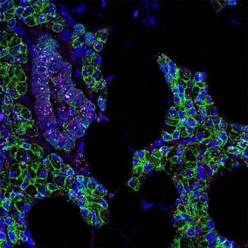 침샘 세포의 신종 코로나 RNA