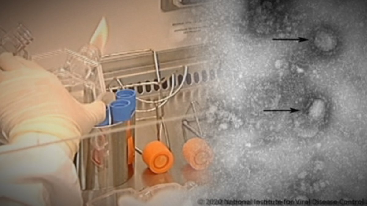 백신·치료제 없는 '우한폐렴'…증상과 예방법은?