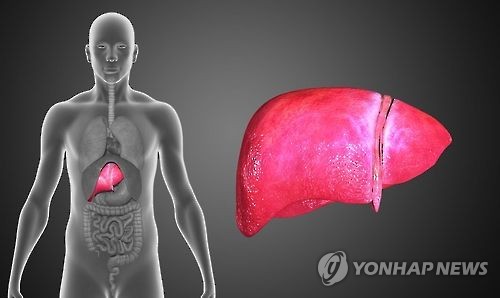 간이식