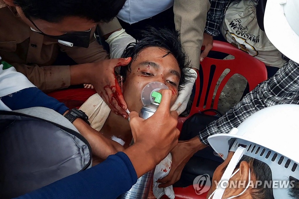 미얀마 남부도시 다웨이에서 28일 열린 반쿠데타 시위에 참가했다가 다쳐서 의료진의 치료를 받고 있는 시민[AFP=연합뉴스]
