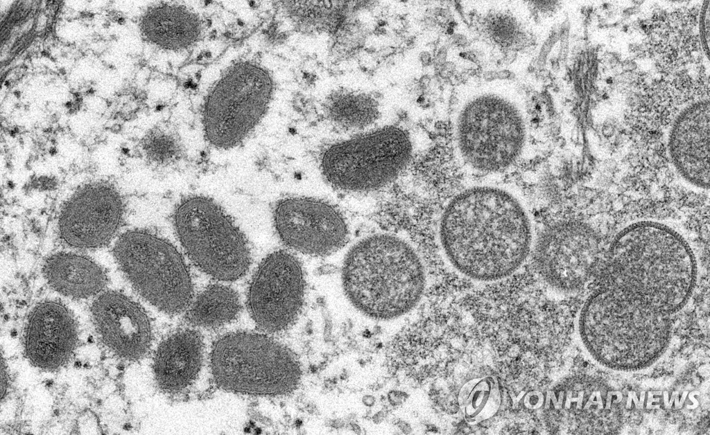 HEALTH-MONKEYPOX/