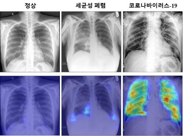 AI-powered X-rays for COVID-19 tests AI-powered X-rays for COVID-19 tests