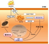 "비알코올성 지방간도 심혈관질환 위험 1.64배 높인다"