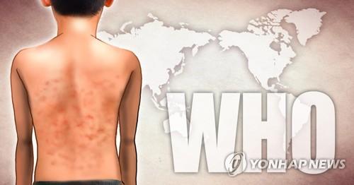 獨보건장관 "자녀 홍역 예방접종 안하면 벌금 물려야"