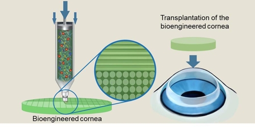 3D프린터로 인공각막 제작…"이식 대기자에 희망"