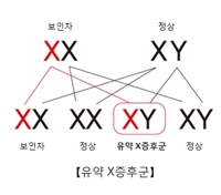 "로바스타틴, 취약 X 증후군에 효과"