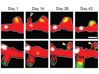 14일 후 생겼다 사라진 수상돌기 가시(상단) 4주 후 안정된 다른 가시(하단)