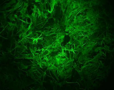 장기 기억 형성에 관여하는 성상교세포(녹색)