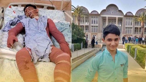 불타는 집에 뛰어들어 2명 구한 15살 이란 소년