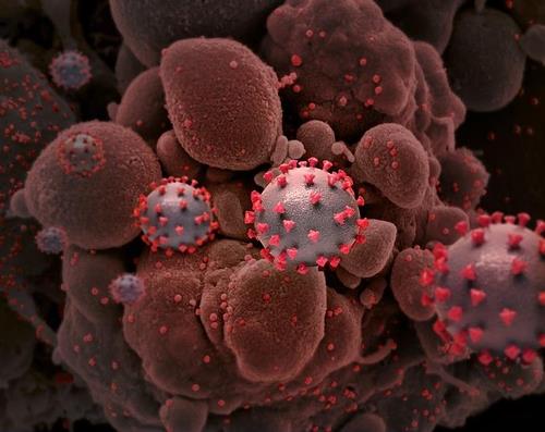 스파이크 단백질로 뒤덮인 신종 코로나바이러스 이미지