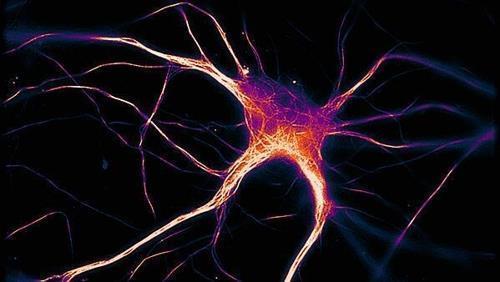 뉴런에 침적한 타우 단백질