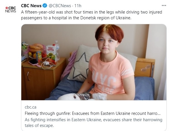 위독한 생명 구한 우크라이나 15세 소녀 리사 체르니셴코