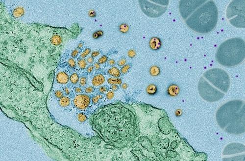 폐 세포에서 세균 독소(자주색)를 빨아들이는 엑소좀(노란색)