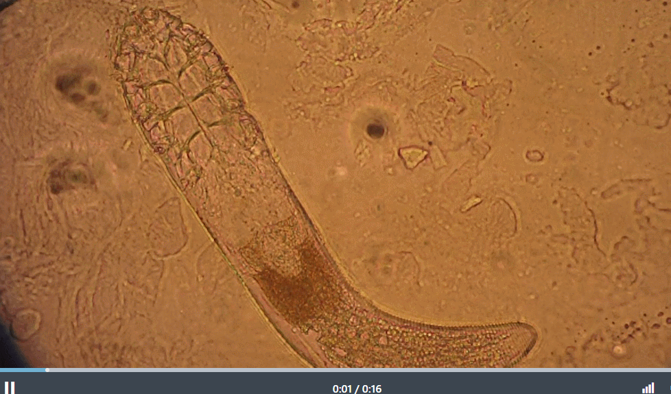 현미경으로 본 D. 폴리쿨로룸의 다리 움직임 