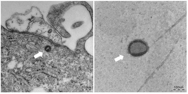 원숭이두창 바이러스 한국분리주 전자 현미경 사진