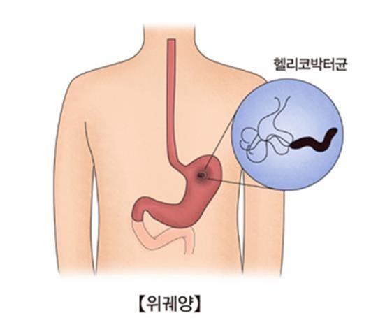 헬리코박터 파일로리