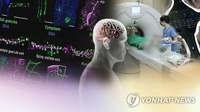 뇌전증 환자 뇌에 세계 첫 신경자극장치 심으니…"발작 80%↓"