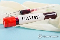 시골마을 80대 할머니의 HIV 감염 미스터리