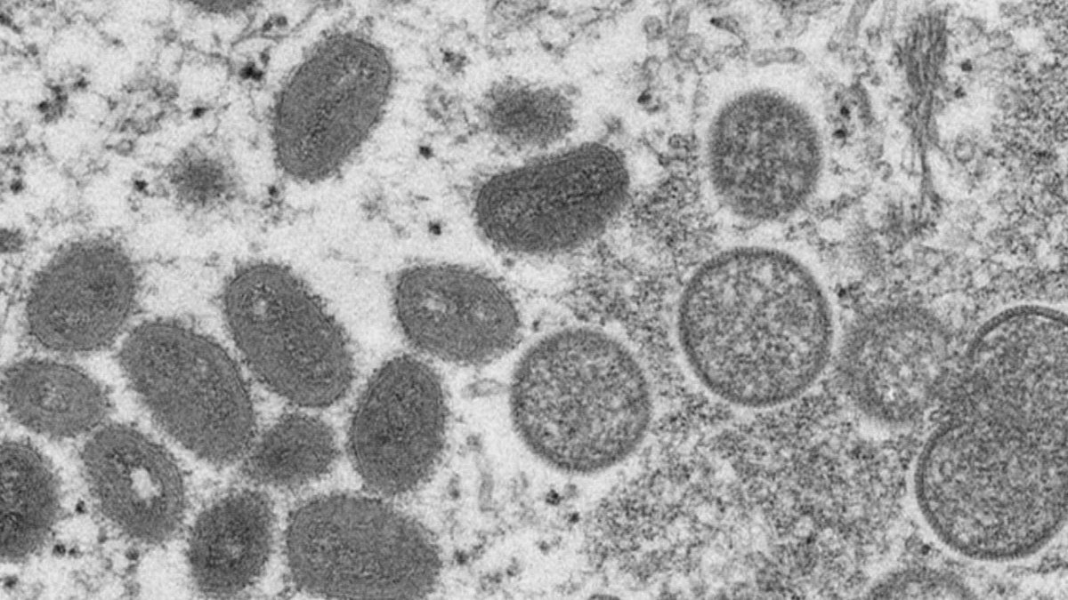 Se agrupará la viruela del mono en el segundo nivel de enfermedades contagiosas