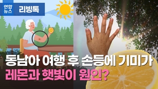  동남아 여행 후 손등에 기미가…레몬과 햇빛이 원인?
