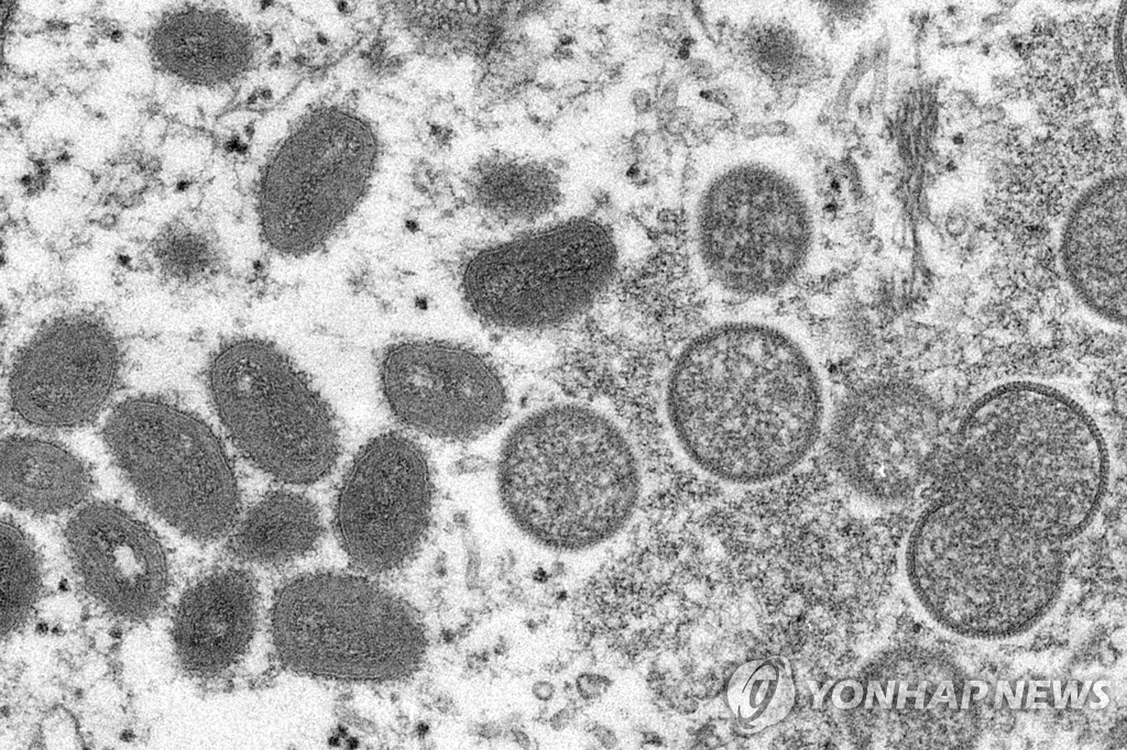 원숭이 두창 바이러스 입자 전자현미경 이미지