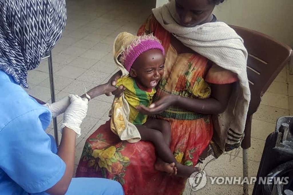 지난 4일 에티오피아 메켈레의 한 병원에서 영양실조 치료 받는 한 살배기 게레지허