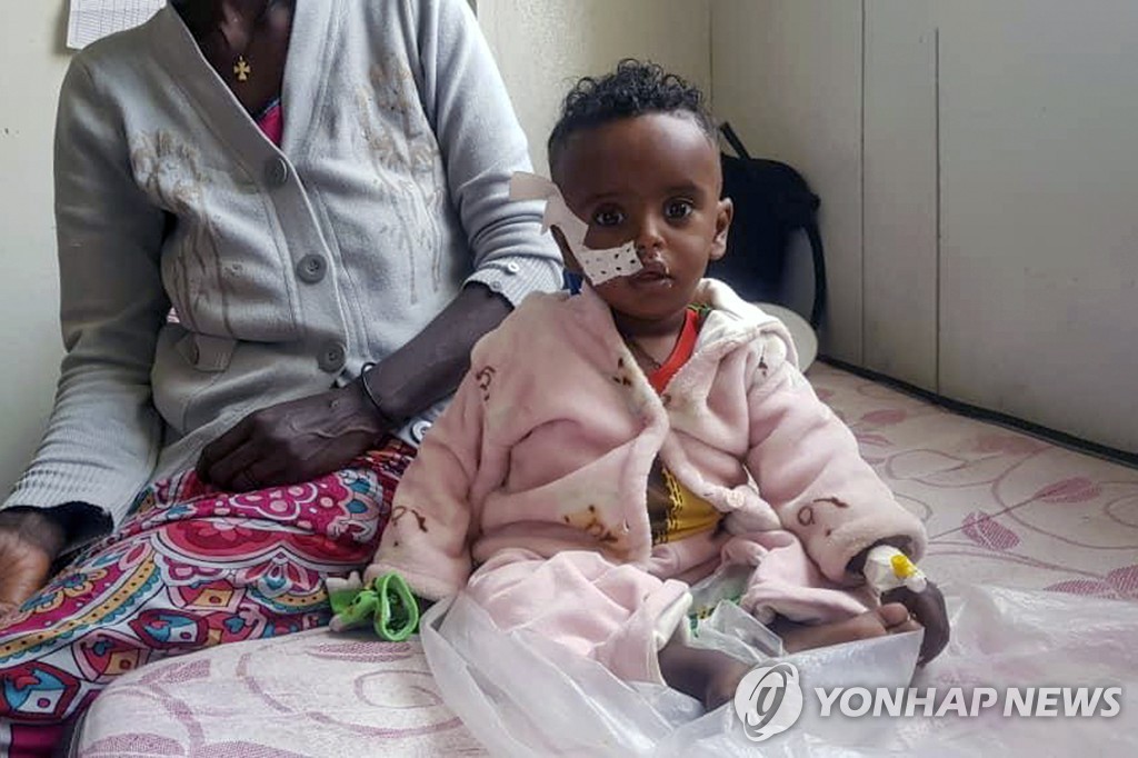 지난 4일 병원에서 영양실조 치료를 받는 티그라이 지역 한살배기 메브라티우