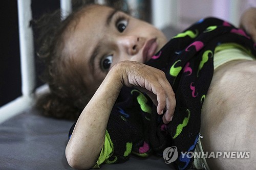 "가자지구 4살 소년 영양실조로 숨져…아사자 58명"