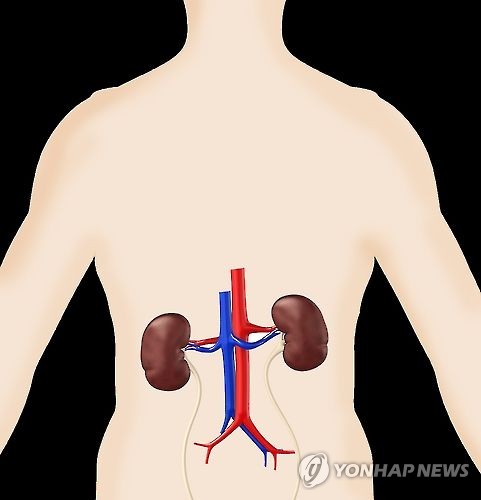 신장질환 (일러스트)