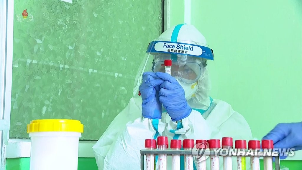 A North Korean medical worker wearing a face shield, believed to be made in China, collects test samples amid a surge in suspected coronavirus cases, in this photo captured from the North's official Korean Central Television. On May 20, 2022, North Korea reported more than 263,370 cases of what it refers to as "fever" and two more deaths in the 24 hours through 6 p.m. the previous day. (For Use Only in the Republic of Korea. No Redistribution) (Yonhap)